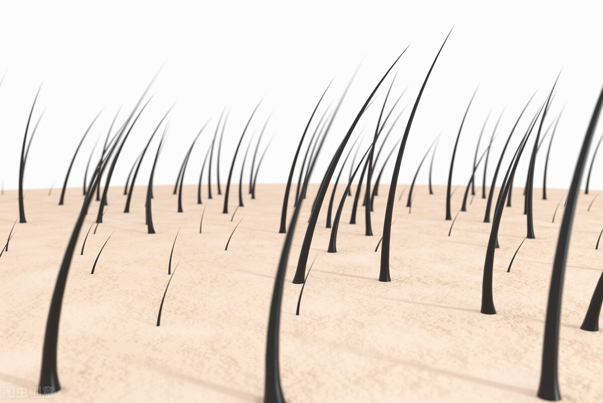 遗传性脱发想知道最佳治疗办法,得了脱发怎么治疗