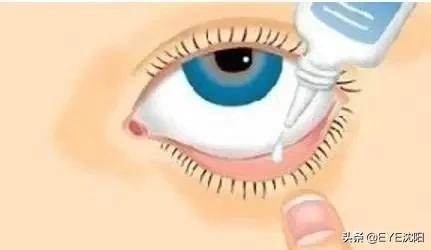 滴错眼药水要怎么处理,滴眼药水太多了怎么补救