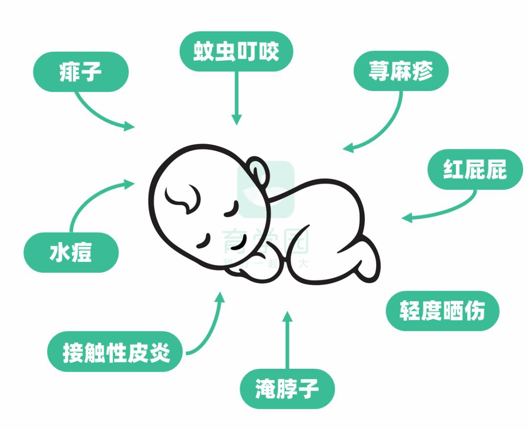 炉甘石不可以涂哪里,炉甘石不能配伍中药