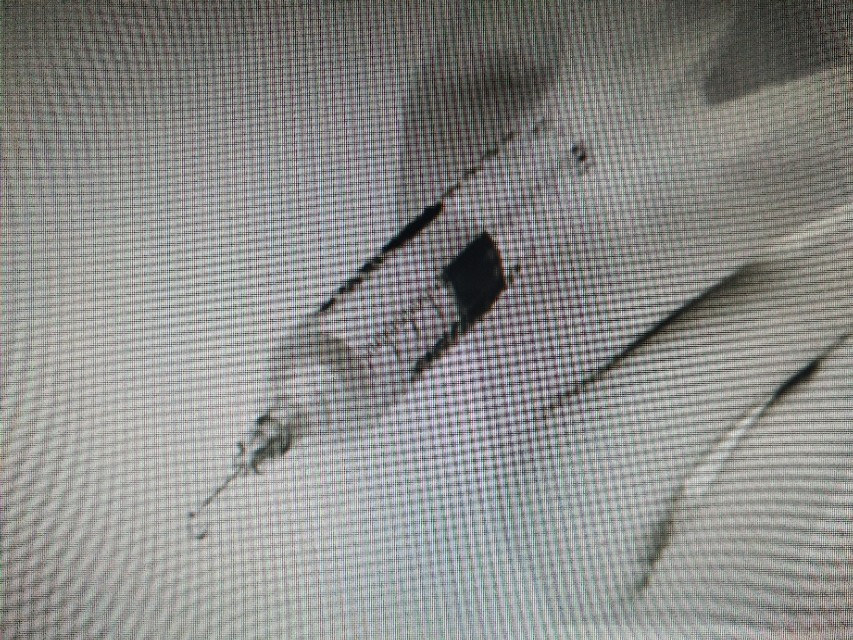 勃起功能障碍的治疗我们了解了，那么如何治疗阴茎异常勃起呢？