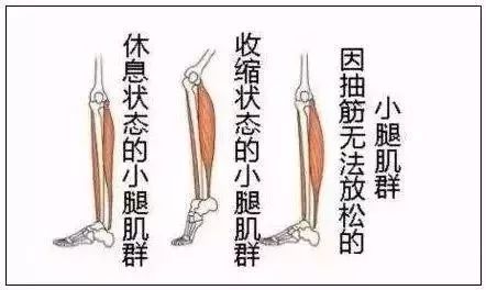 睡觉时小腿抽筋的解决方法,睡觉时小腿抽筋的原因中医