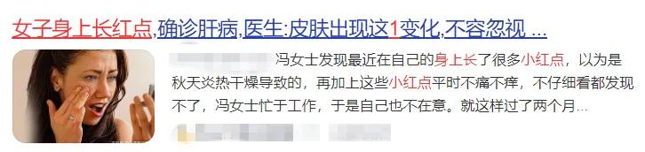 身上突然有很多小红点一会又消失,身上突然出现小红点用什么药