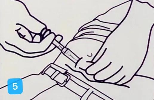 打皮下针拔针出血怎么办,皮下注射有回血继续注射会死吗