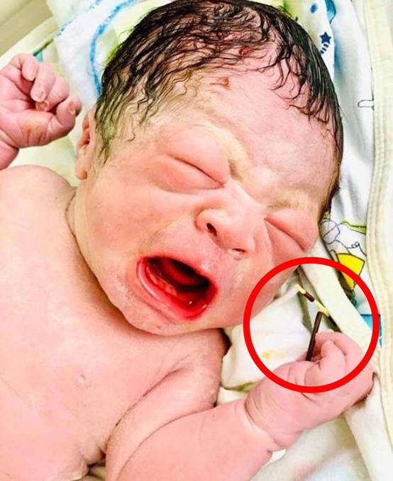 宝宝戴着节育器出生,命中注定的宝宝