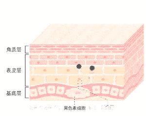 不做黄脸婆教你如何淡化色斑,色斑修复的最佳方法