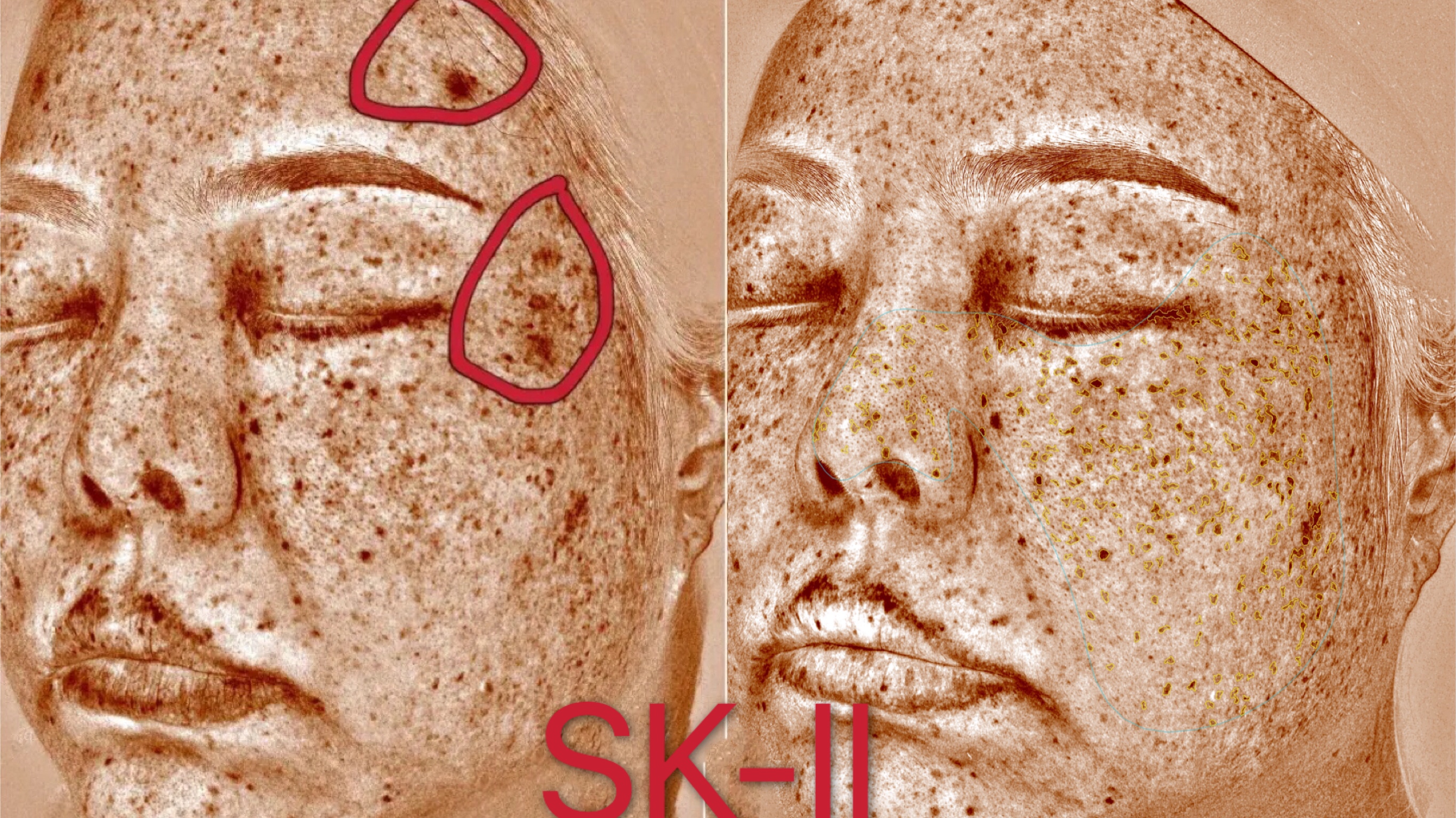 玉兰油小滴管和小白瓶哪款好用,sk2小灯泡好还是玉兰油小白瓶好