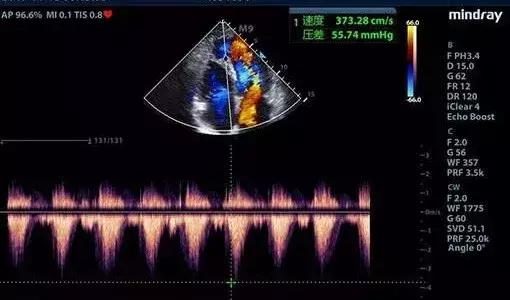 我明明开的是彩超,图像怎么是黑白的?