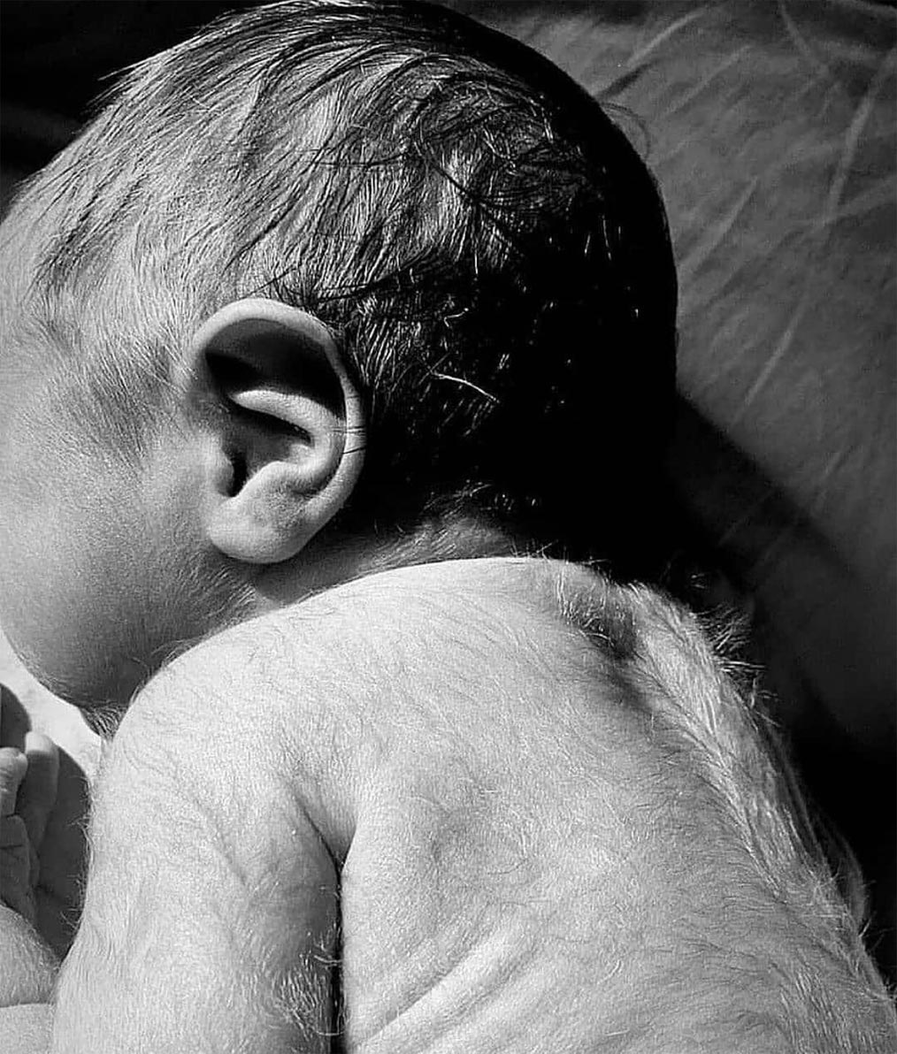 新生儿出现脱皮,新生儿34天脱发正确方法