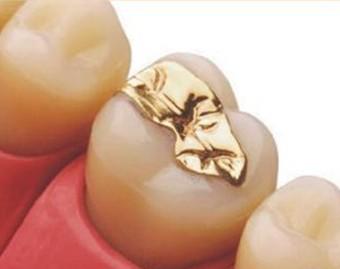 补牙学问,补牙真的是小洞不补大洞吃苦吗