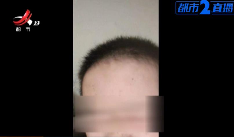 南昌：抽奖中了一把“*药火**枪”，孩子全脸被灼伤