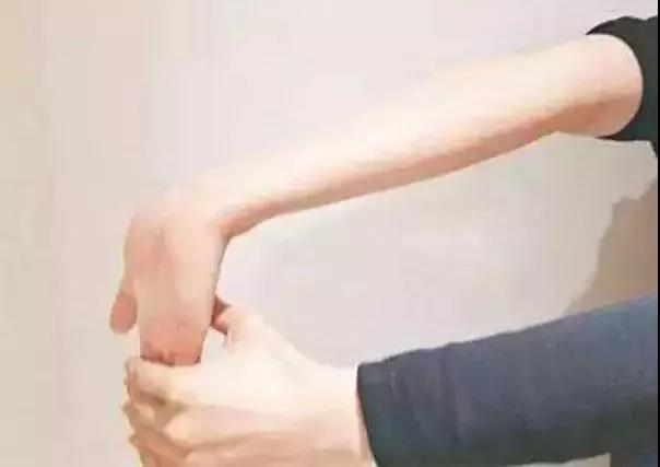 为什么不会打网球还能患上网球肘,不打网球的人会患上网球肘吗