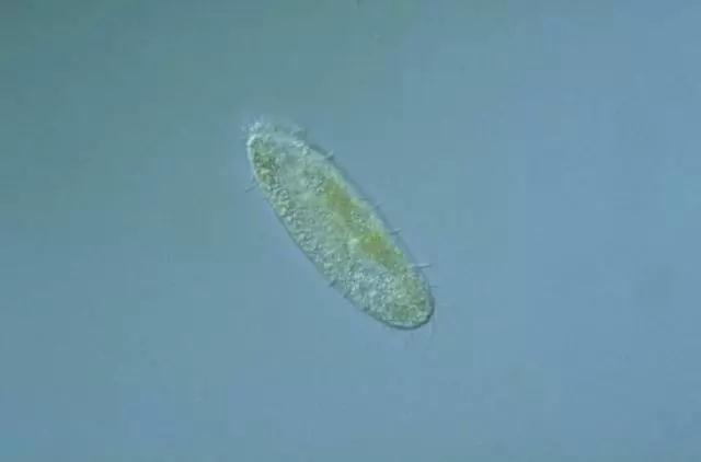 收藏!24种污水处理微生物菌相及指导意义,环保人必看(多图)