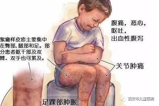 12岁男孩看着很瘦但有100多斤,11岁男孩100斤瘦到60斤