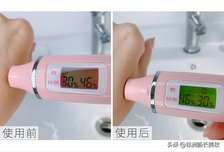 万能芦荟胶神奇功效,万能芦荟胶祛痘的方法