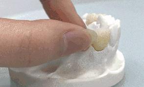 缺牙真的伤不起,缺牙对你最大的影响