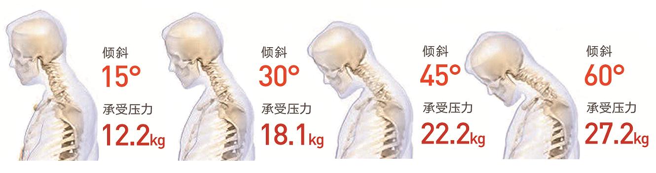 攀高颈椎按摩仪测评,skg智能颈椎按摩仪哪款最好用