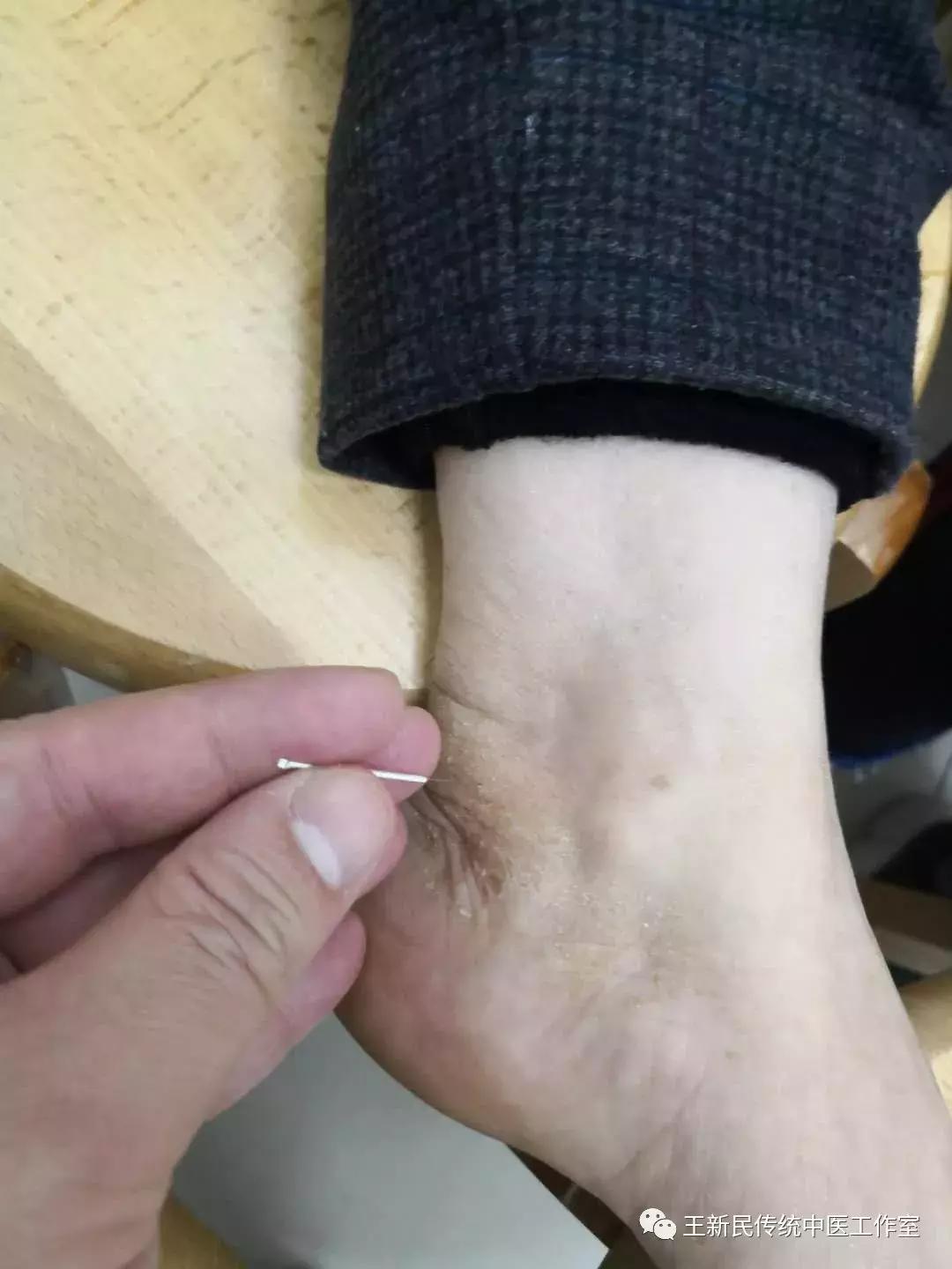 王新民中医专栏|为什么她的胃里面总是怕冷？