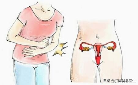 长沙肛肠医院治痔疮,长沙东大肛肠医院做痔疮手术好吗