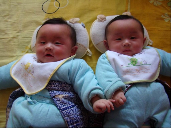 2个月宝宝脸上起红疙瘩是湿疹吗,一岁多小宝宝脸上干性湿疹