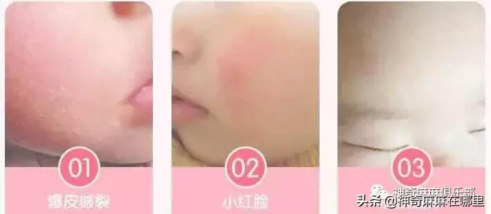 秋冬季润肤霜推荐儿童,干皮可以用的宝宝霜