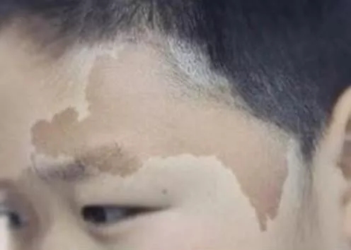 片仔癀护肤品去斑有效吗,片仔癀的护肤品祛斑吗