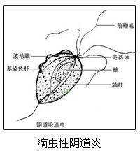 白带多有异味用什么药治疗好,妇科病白带多有异味用什么药