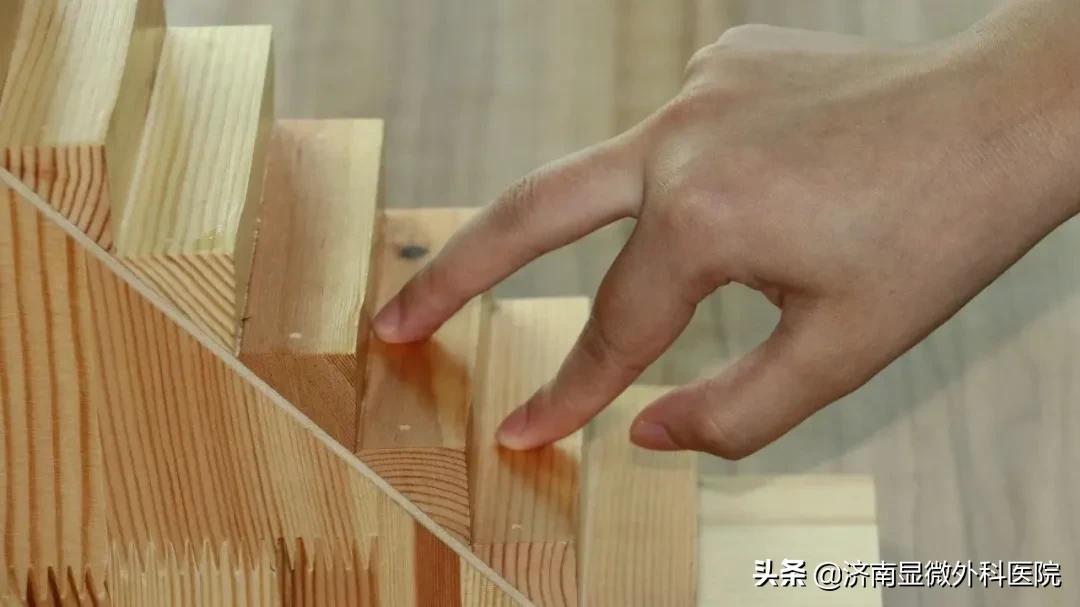 显微镜下男性复通术需要多少钱,显微镜下的手指再植