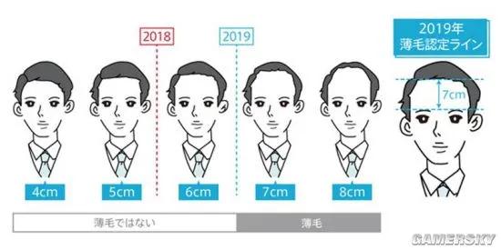 所以秃头的标准是发际线高≥7cm？头秃代表不再是中老年独扛大旗，90后、00后也在积极踊跃加入组织