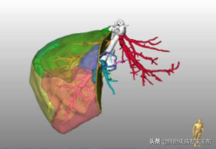 早期肝癌治疗最佳方法是肝移植吗,早期肝癌要介入治疗几次