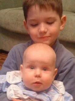 法令纹和苹果肌下垂哪个更显老,脸上肉多但是下垂