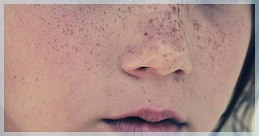 ​真是个“斑”脚石！（上集）