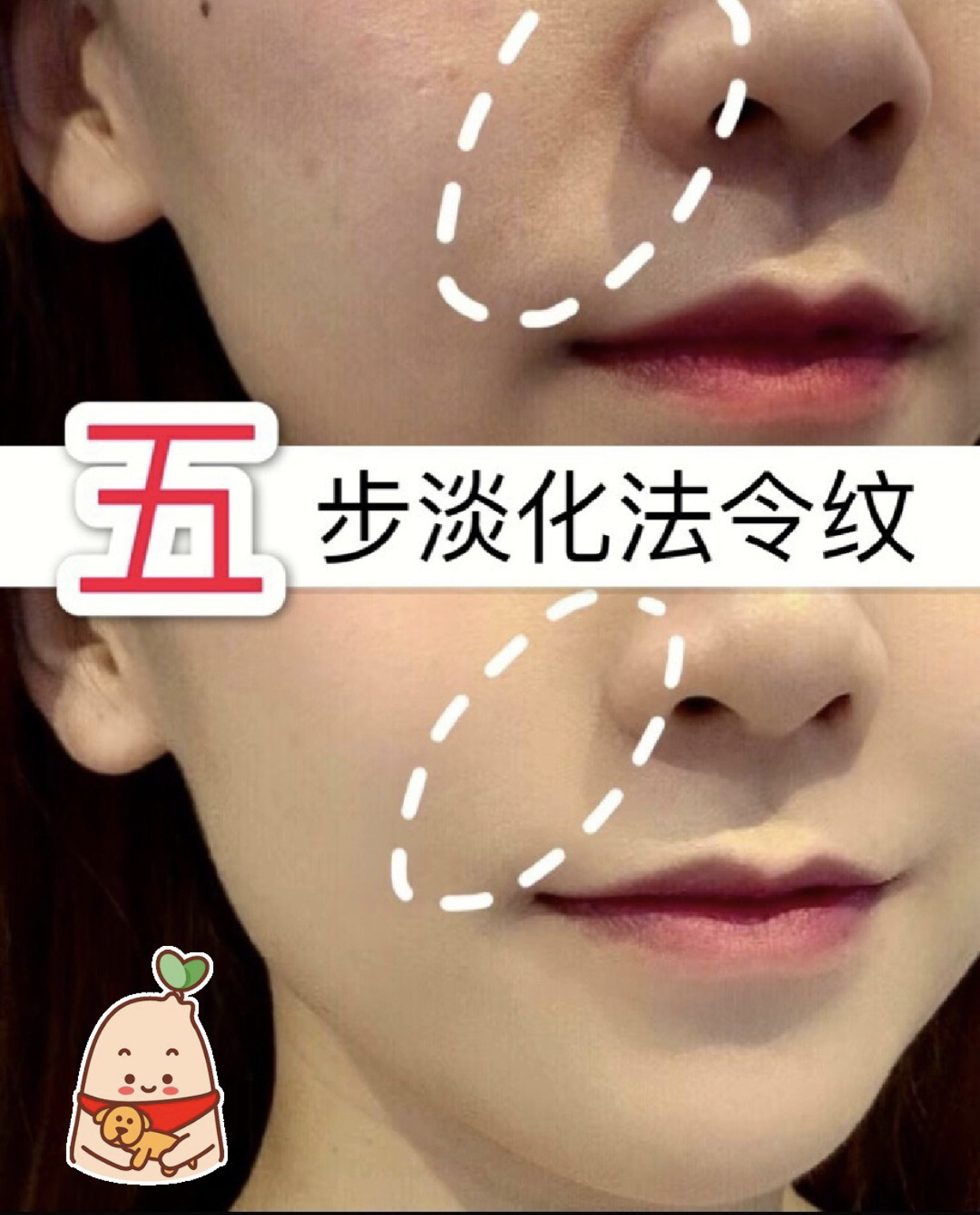 怎样淡化法令纹泪沟,五个动作轻松淡化法令纹嘴角纹