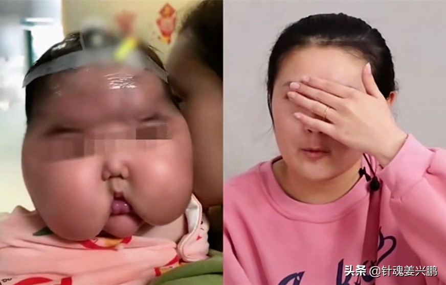 女宝宝一个月胖3斤，全身长汗毛！医生：当心这款黑心的宝宝霜