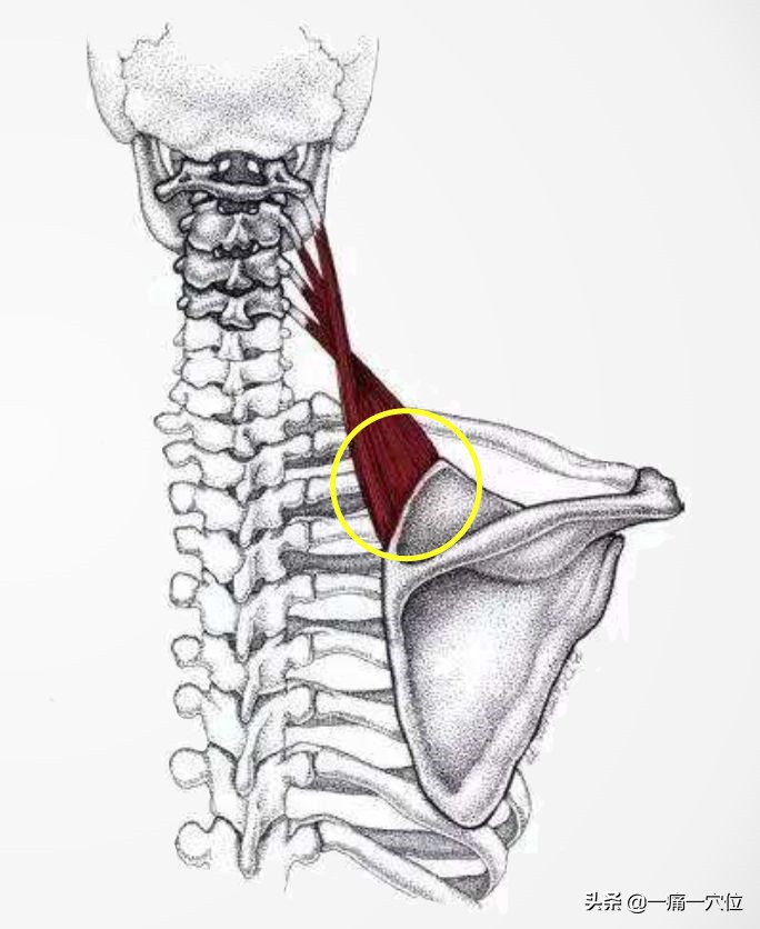 颈肩困痛怎么办,颈肩综合征自我锻炼方法