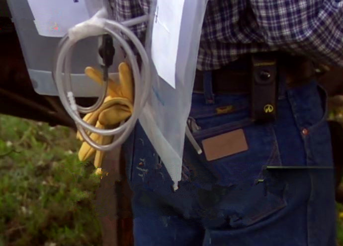 男性和女性排便差异,男性排屁量