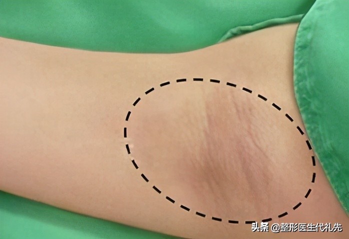 腋臭科普小知识,腋臭科普题目