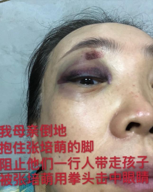 苏炳添说张培萌家暴是真的吗,苏炳添张培萌为什么打岳母