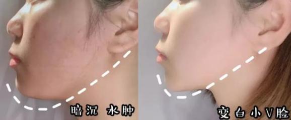 大长今宋慧乔金喜善,大长今金喜善宋慧乔