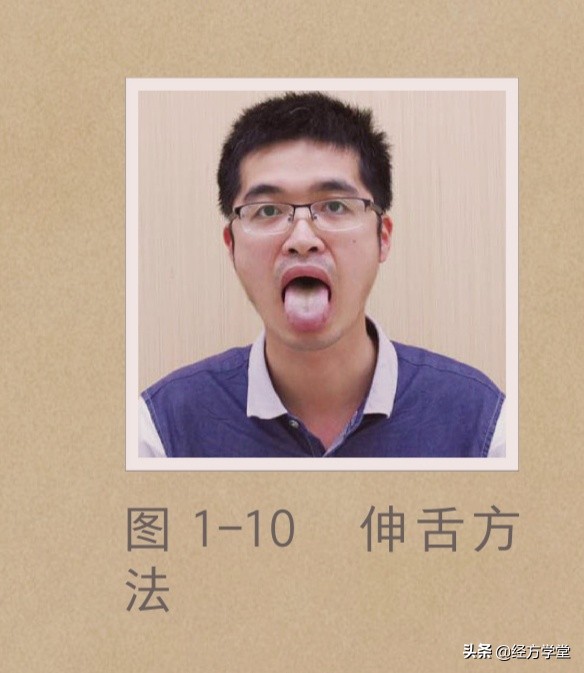 观舌养生舌诊入门一学就会,舌诊图片与经方治疗