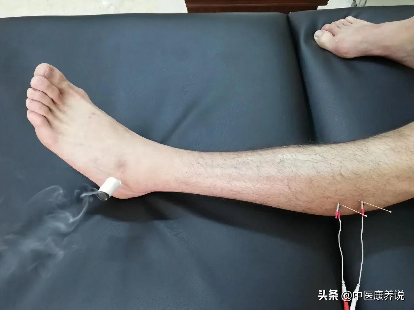 #药食同源篇#第七十六课“长寿草”艾叶