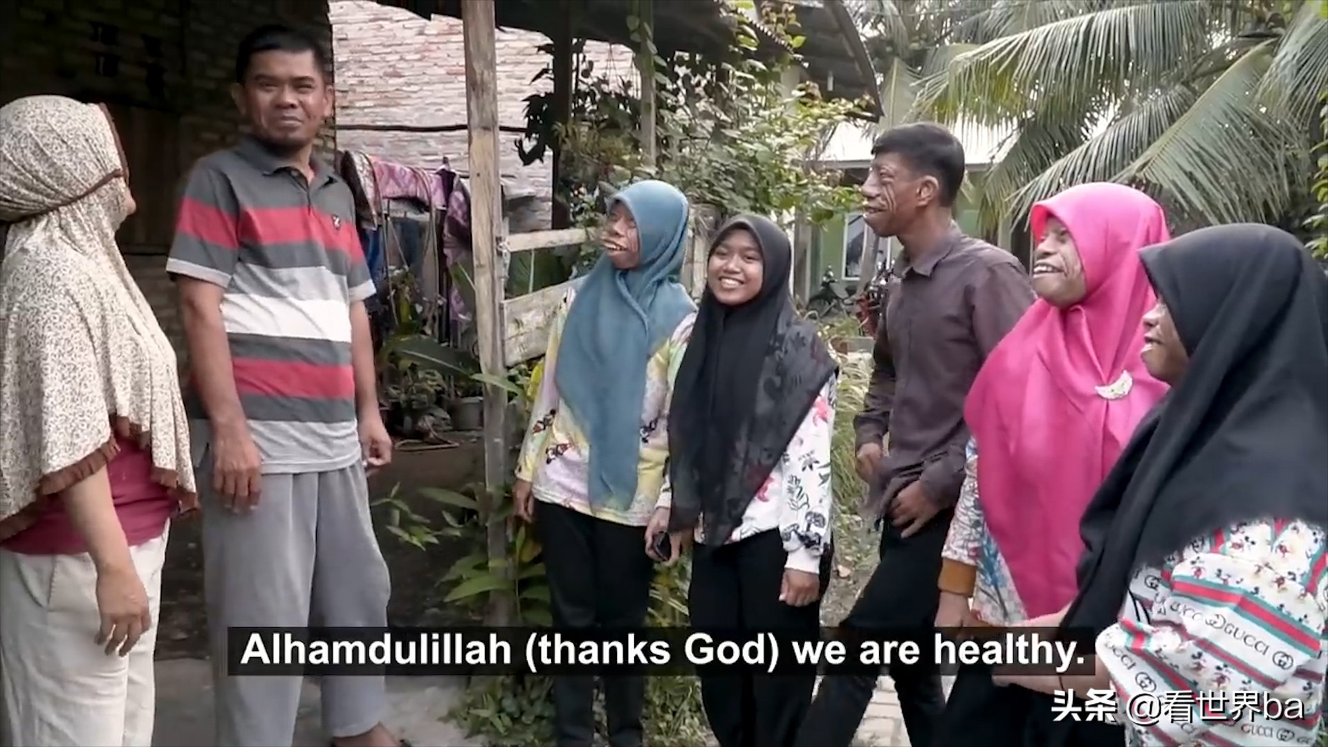 印尼家族怪脸,印尼怪病