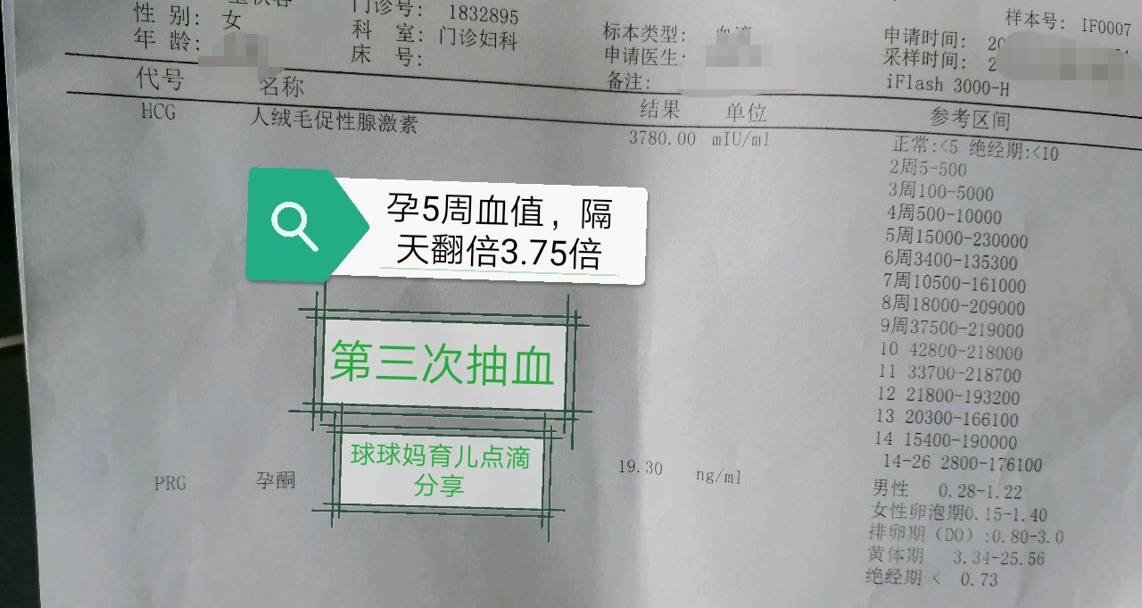 孕期报告单大全,孕期检查报告有哪些