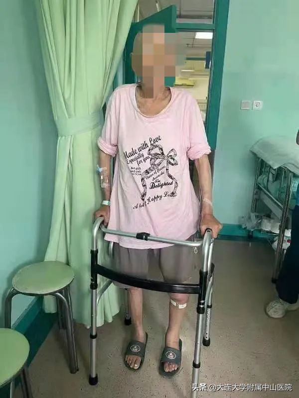 胫腓骨粉碎性骨折自愈动画演示,骨折恢复成功案例