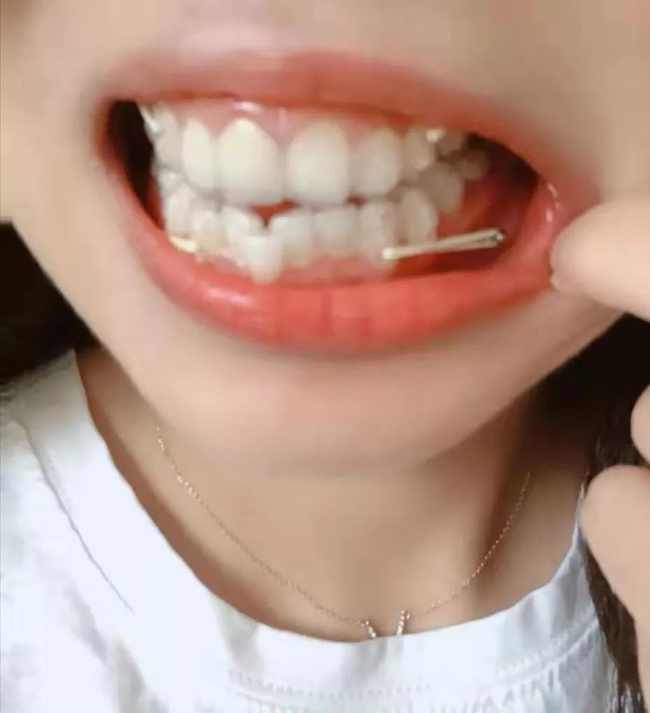 重启后的我,重启后时间变了是为什么