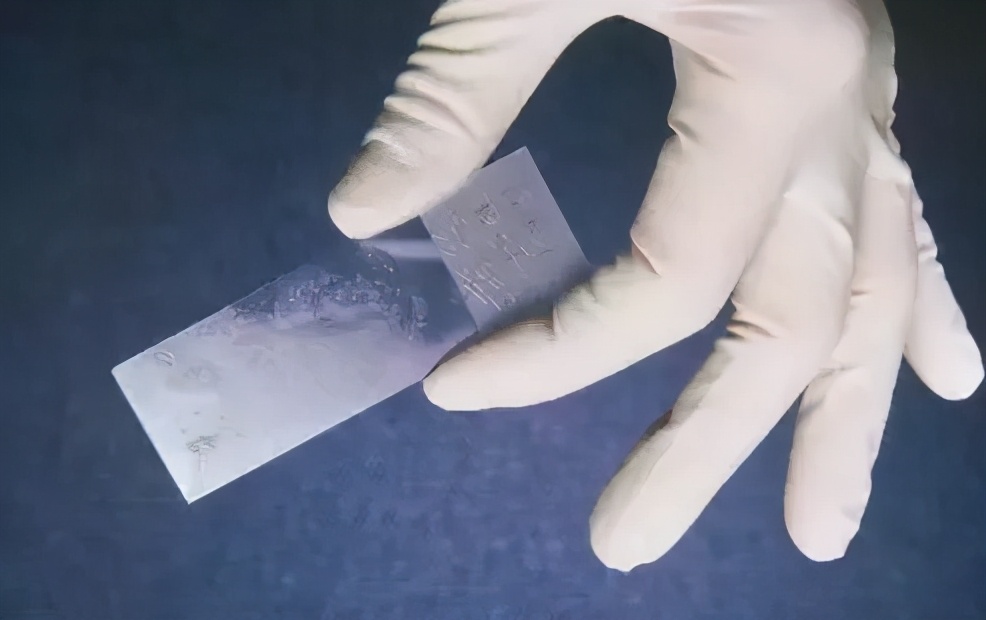 hpv和tct检查哪个更好筛查宫颈癌,宫颈癌筛查tct和hpv能一起做吗