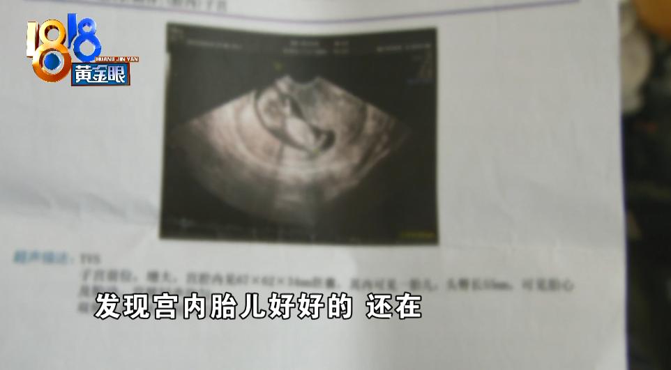 怀孕做过清宫医生能看出吗,做过清宫好不好怀孕