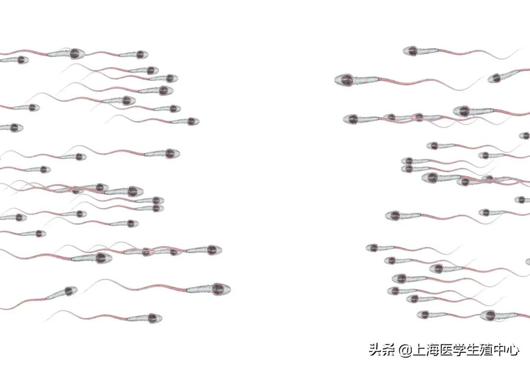 通过精子颜色可以看出精子质量吗,精子质量主要看哪几个指标