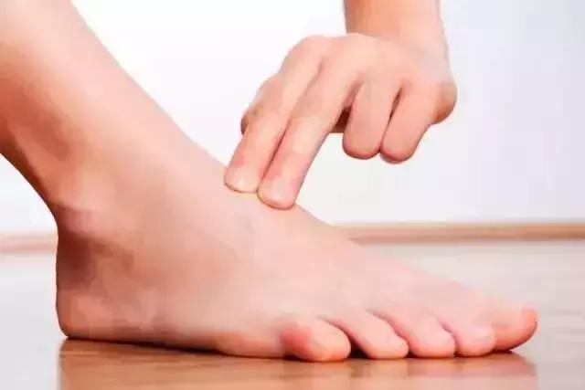 血管弹性变差怎么办,血管硬了很难再软回去