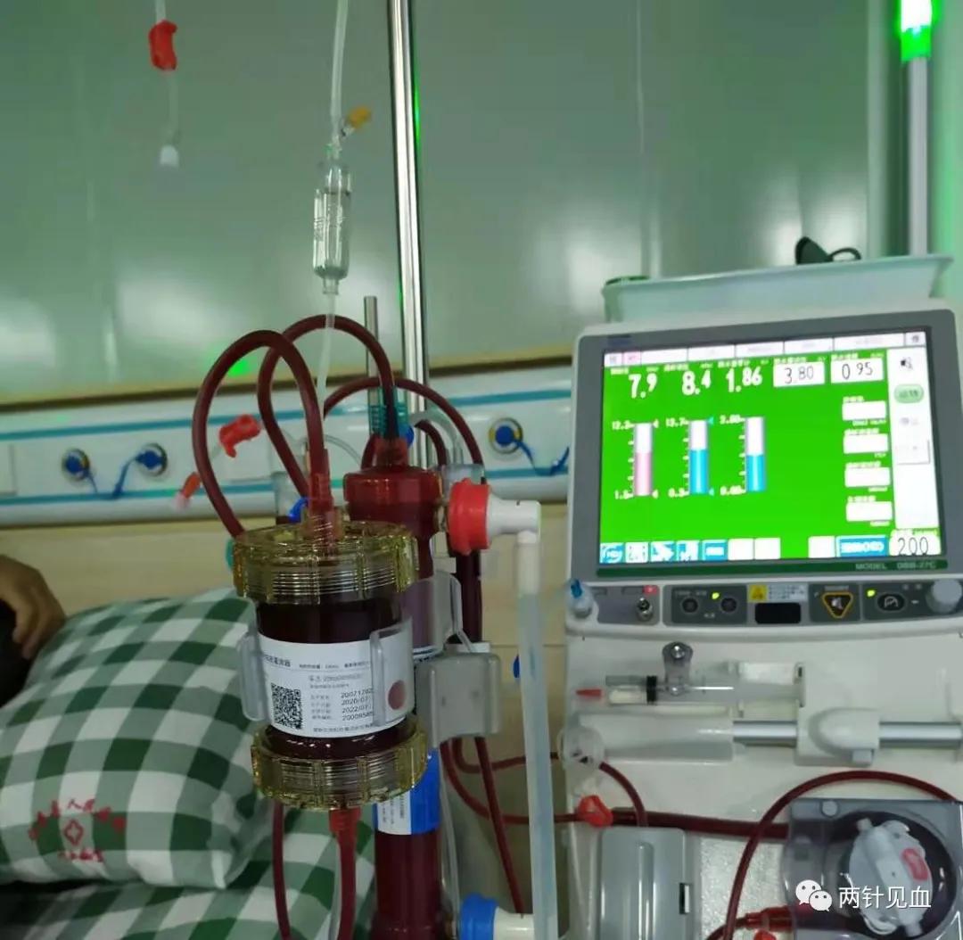 血液灌流科普,血液灌流是怎样的一个过程