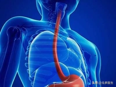 肚子疼真的那么简单吗？——慢性腹痛的一点点点的事